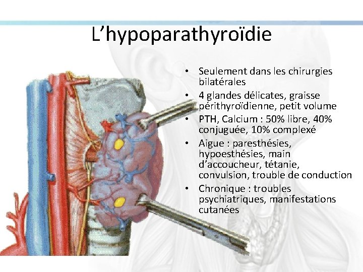 L’hypoparathyroïdie • Seulement dans les chirurgies bilatérales • 4 glandes délicates, graisse périthyroïdienne, petit