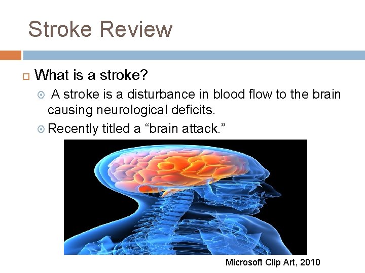 Stroke Review What is a stroke? A stroke is a disturbance in blood flow