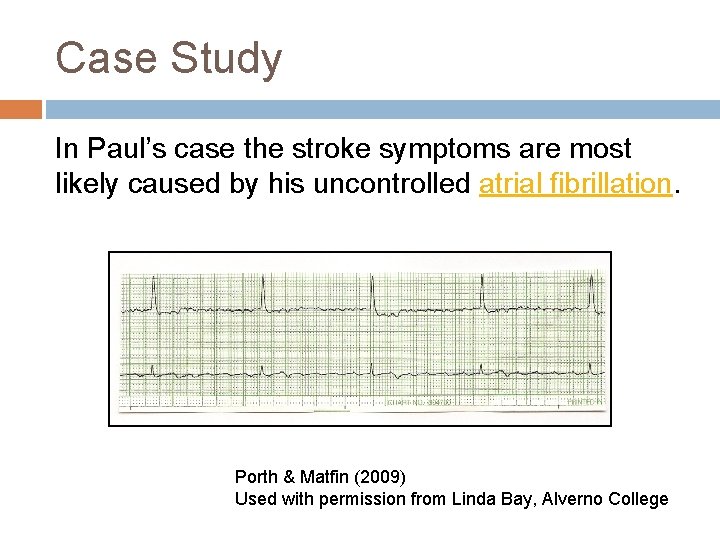 Case Study In Paul’s case the stroke symptoms are most likely caused by his