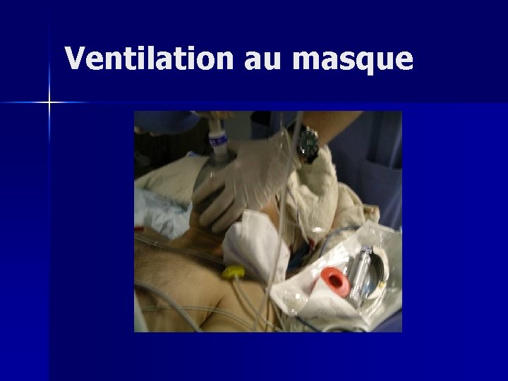 Ventilation au masque 