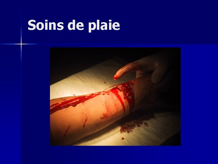 Soins de plaie 