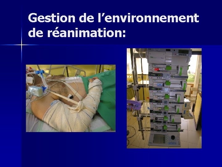 Gestion de l’environnement de réanimation: 