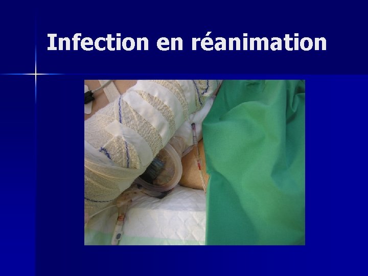 Infection en réanimation 