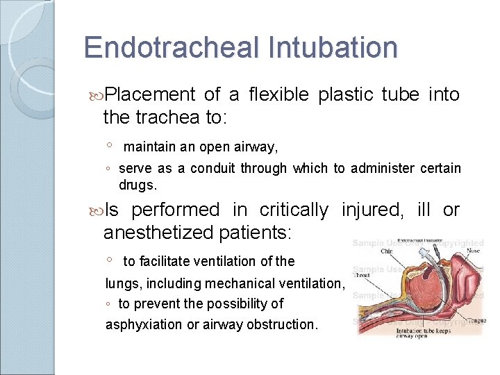 Endotracheal Intubation Placement of a flexible plastic tube into the trachea to: ◦ maintain