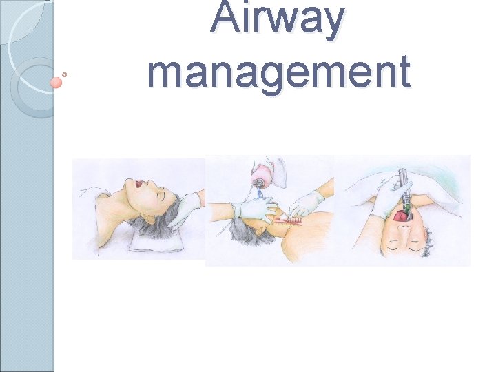 Airway management 