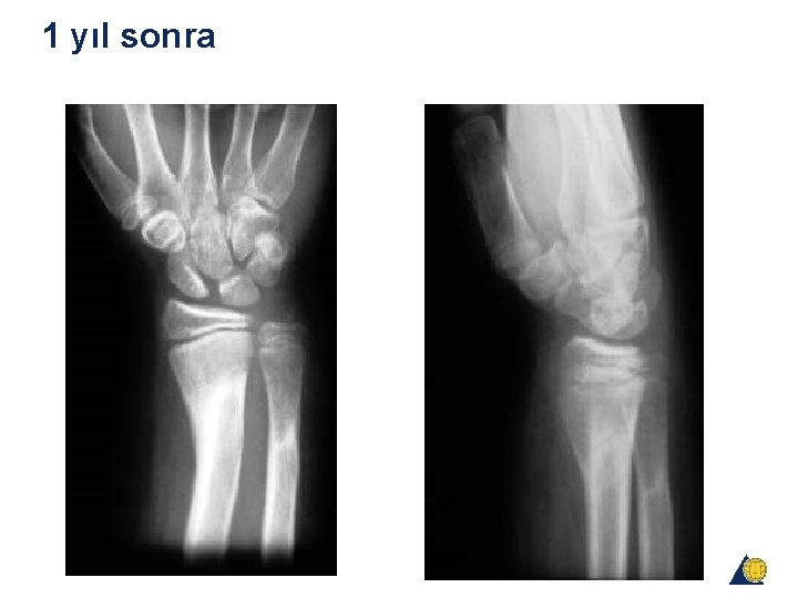 1 yıl sonra 1 yıl sonra