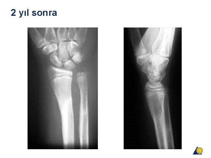 2 yıl sonra 2 yıl sonra