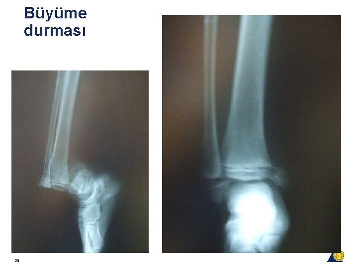 Büyüme durması 28 Büyüme durması 28