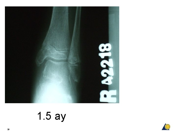 1. 5 ay 29 1. 5 ay 29
