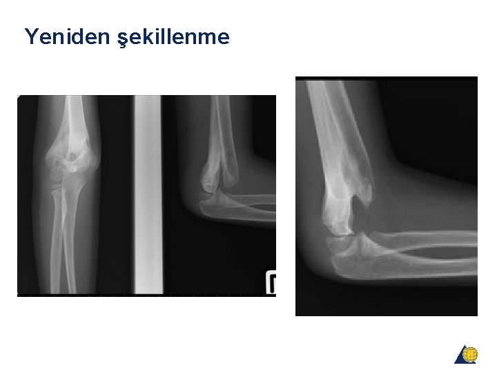 Yeniden şekillenme Yeniden şekillenme
