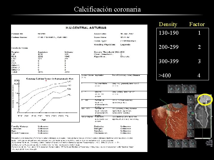 Calcificación coronaria Density 130 -190 Factor 1 200 -299 2 300 -399 3 >400