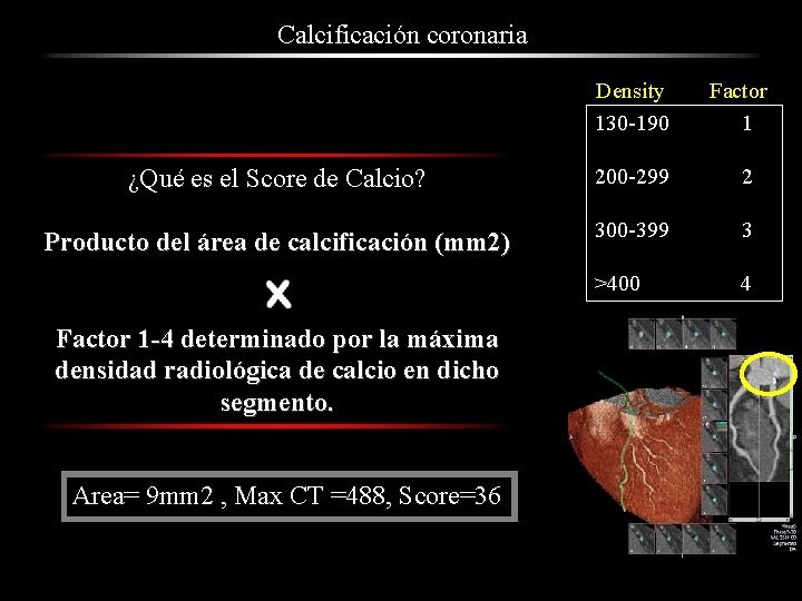 Calcificación coronaria Density 130 -190 Factor 1 ¿Qué es el Score de Calcio? 200