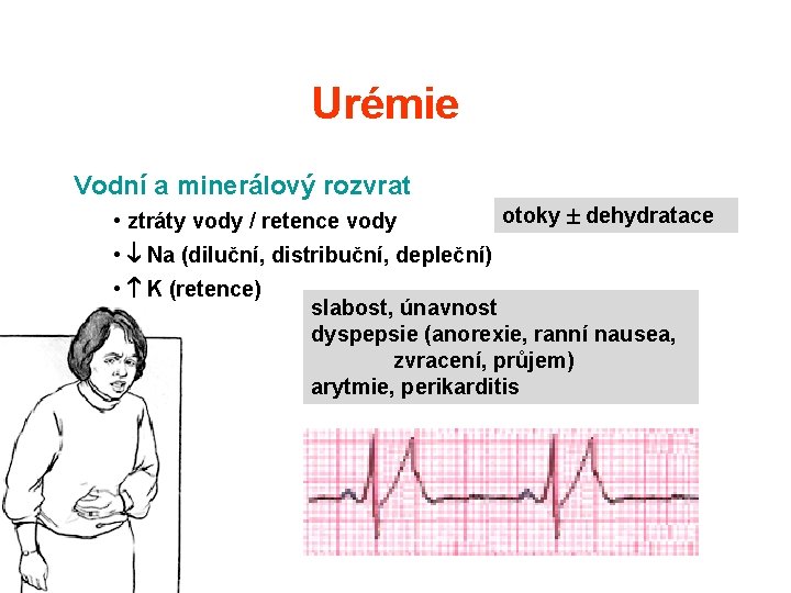 Urémie Vodní a minerálový rozvrat • ztráty vody / retence vody otoky dehydratace • Urémie Vodní a minerálový rozvrat • ztráty vody / retence vody otoky dehydratace •