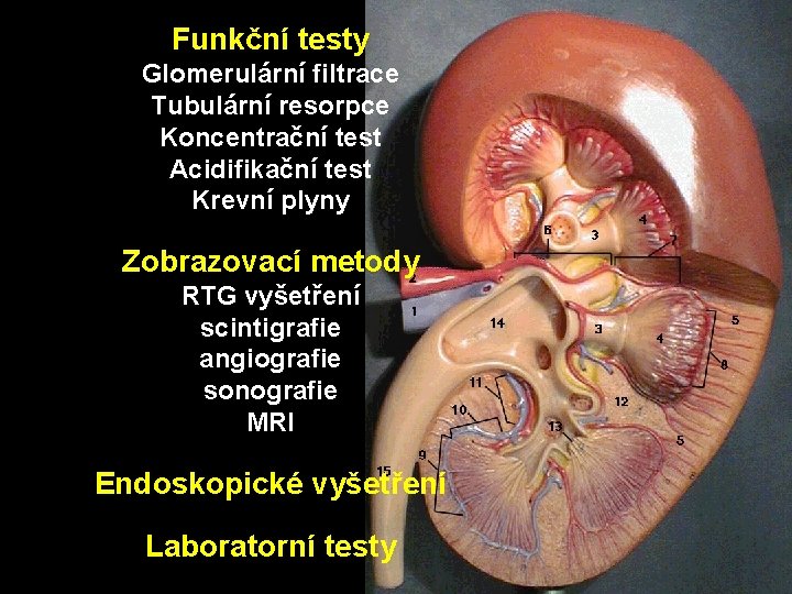 Funkční testy Glomerulární filtrace Tubulární resorpce Koncentrační test Acidifikační test Krevní plyny Zobrazovací metody Funkční testy Glomerulární filtrace Tubulární resorpce Koncentrační test Acidifikační test Krevní plyny Zobrazovací metody