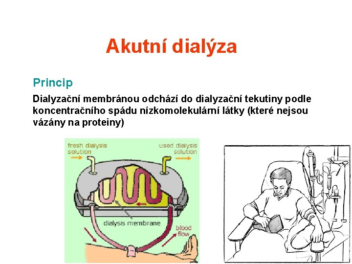 Akutní dialýza Princip Dialyzační membránou odchází do dialyzační tekutiny podle koncentračního spádu nízkomolekulární látky Akutní dialýza Princip Dialyzační membránou odchází do dialyzační tekutiny podle koncentračního spádu nízkomolekulární látky