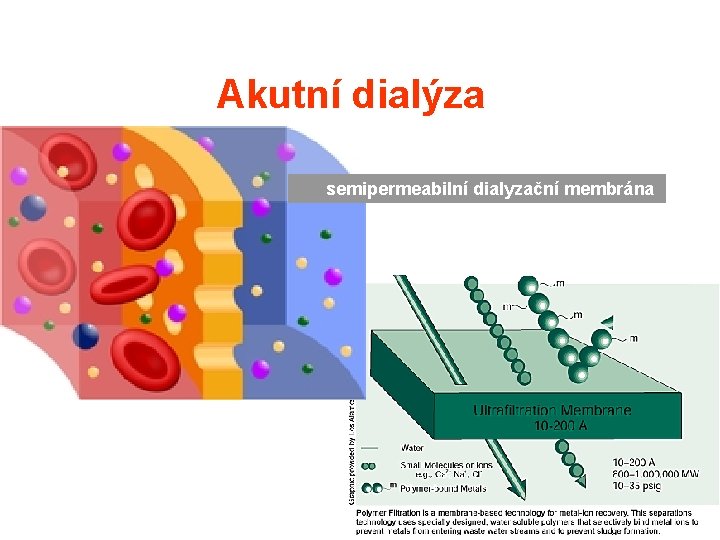 Akutní dialýza semipermeabilní dialyzační membrána Akutní dialýza semipermeabilní dialyzační membrána