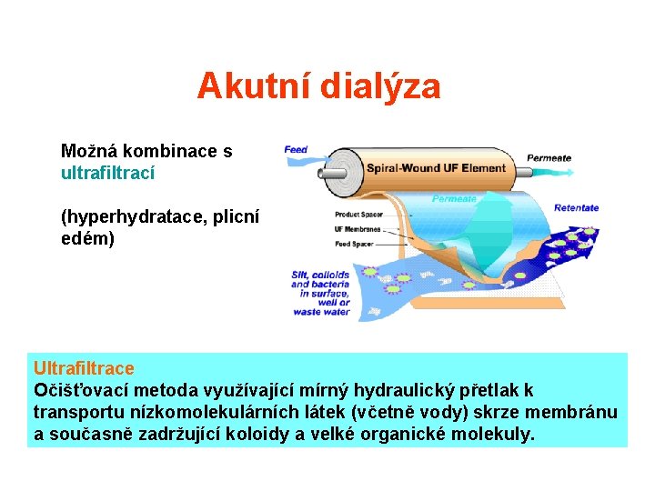 Akutní dialýza Možná kombinace s ultrafiltrací (hyperhydratace, plicní edém) Ultrafiltrace Očišťovací metoda využívající mírný Akutní dialýza Možná kombinace s ultrafiltrací (hyperhydratace, plicní edém) Ultrafiltrace Očišťovací metoda využívající mírný