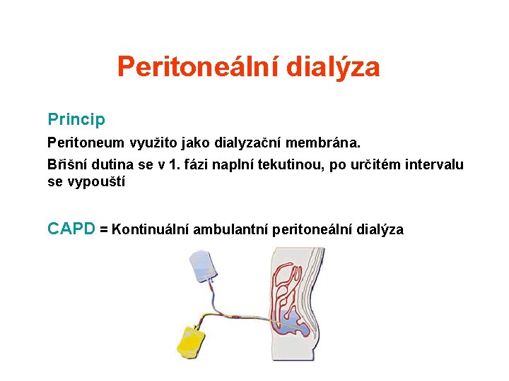 Peritoneální dialýza Princip Peritoneum využito jako dialyzační membrána. Břišní dutina se v 1. fázi Peritoneální dialýza Princip Peritoneum využito jako dialyzační membrána. Břišní dutina se v 1. fázi