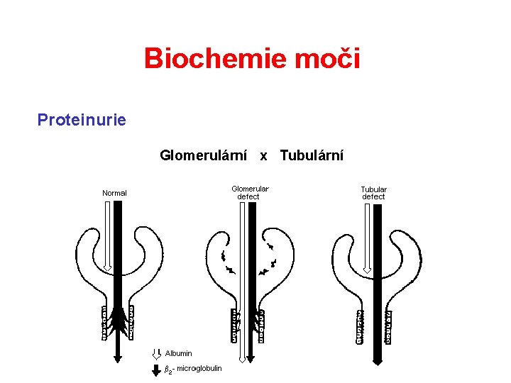 Biochemie moči Proteinurie Glomerulární x Tubulární Biochemie moči Proteinurie Glomerulární x Tubulární