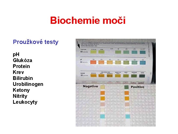 Biochemie moči Proužkové testy p. H Glukóza Protein Krev Bilirubin Urobilinogen Ketony Nitrity Leukocyty Biochemie moči Proužkové testy p. H Glukóza Protein Krev Bilirubin Urobilinogen Ketony Nitrity Leukocyty