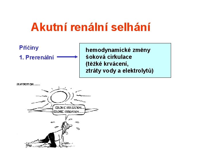 Akutní renální selhání Příčiny 1. Prerenální hemodynamické změny šoková cirkulace (těžké krvácení, ztráty vody Akutní renální selhání Příčiny 1. Prerenální hemodynamické změny šoková cirkulace (těžké krvácení, ztráty vody
