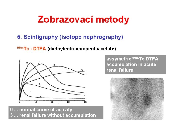 Zobrazovací metody 5. Scintigraphy (isotope nephrography) 99 m. Tc - DTPA (diethylentriaminpentaacetate) assymetric 99 Zobrazovací metody 5. Scintigraphy (isotope nephrography) 99 m. Tc - DTPA (diethylentriaminpentaacetate) assymetric 99