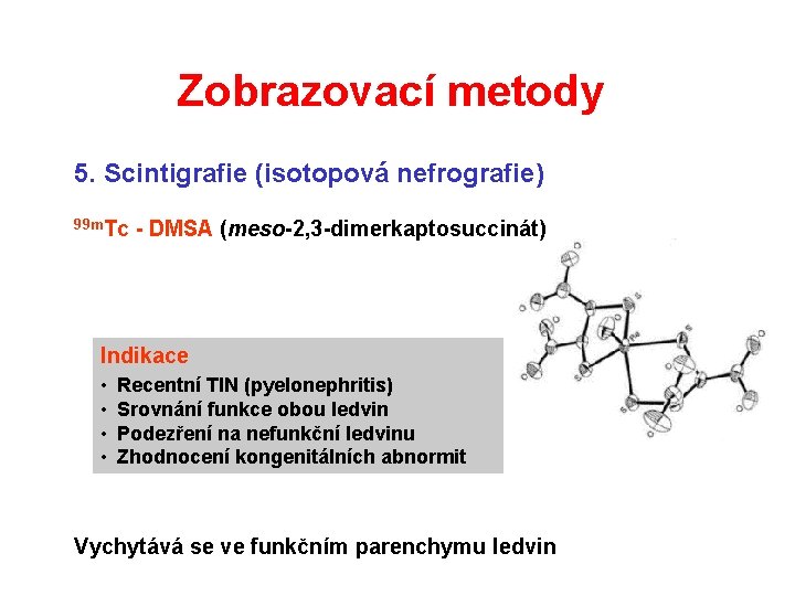 Zobrazovací metody 5. Scintigrafie (isotopová nefrografie) 99 m. Tc - DMSA (meso-2, 3 -dimerkaptosuccinát) Zobrazovací metody 5. Scintigrafie (isotopová nefrografie) 99 m. Tc - DMSA (meso-2, 3 -dimerkaptosuccinát)