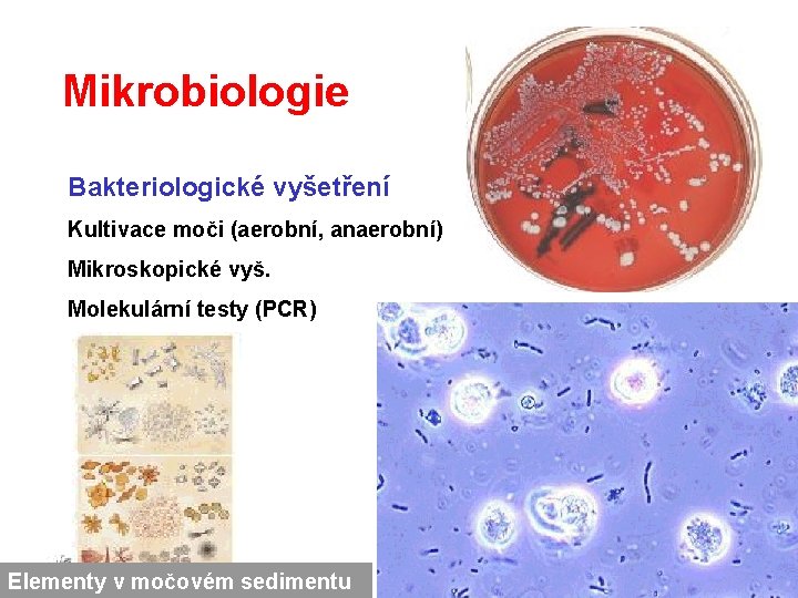 Mikrobiologie Bakteriologické vyšetření Kultivace moči (aerobní, anaerobní) Mikroskopické vyš. Molekulární testy (PCR) Elementy v Mikrobiologie Bakteriologické vyšetření Kultivace moči (aerobní, anaerobní) Mikroskopické vyš. Molekulární testy (PCR) Elementy v