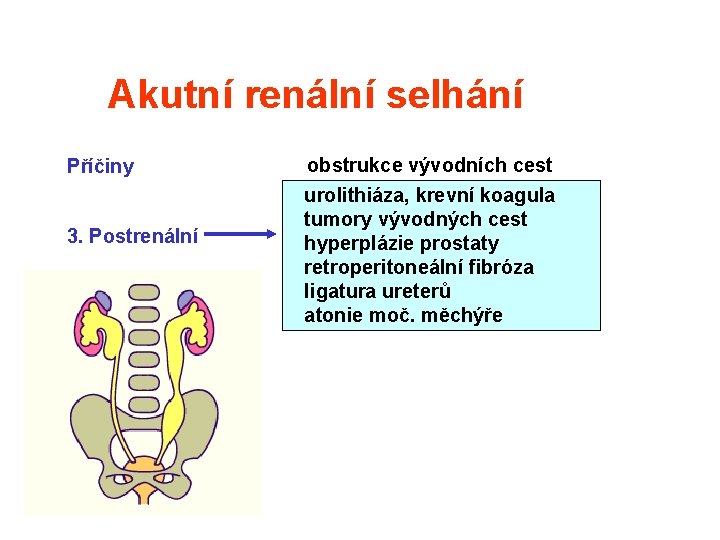 Akutní renální selhání Příčiny 3. Postrenální obstrukce vývodních cest urolithiáza, krevní koagula tumory vývodných Akutní renální selhání Příčiny 3. Postrenální obstrukce vývodních cest urolithiáza, krevní koagula tumory vývodných