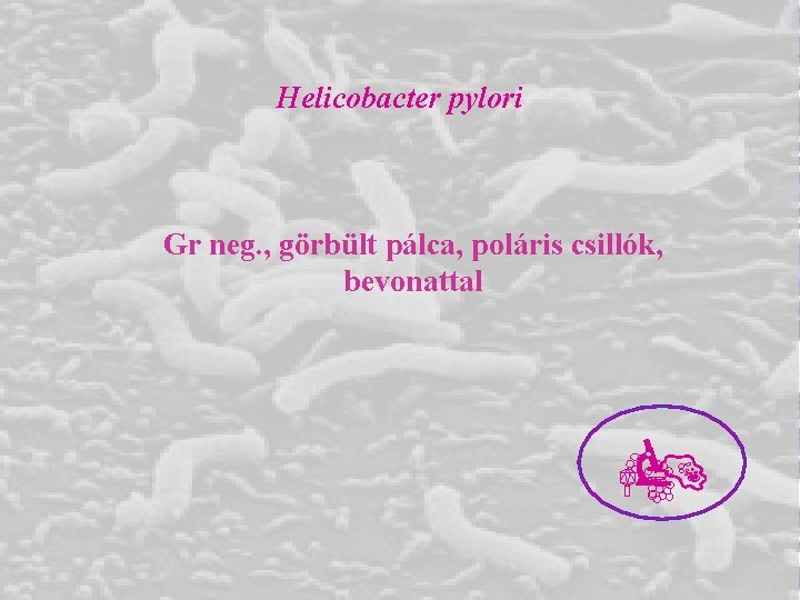 Helicobacter pylori Gr neg. , görbült pálca, poláris csillók, bevonattal Helicobacter pylori Gr neg. , görbült pálca, poláris csillók, bevonattal