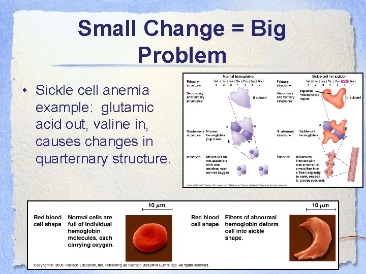 Small Change = Big Problem • Sickle cell anemia example: glutamic acid out, valine