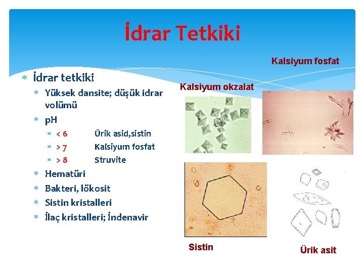 İdrar Tetkiki Kalsiyum fosfat İdrar tetkiki Yüksek dansite; düşük idrar volümü p. H <6