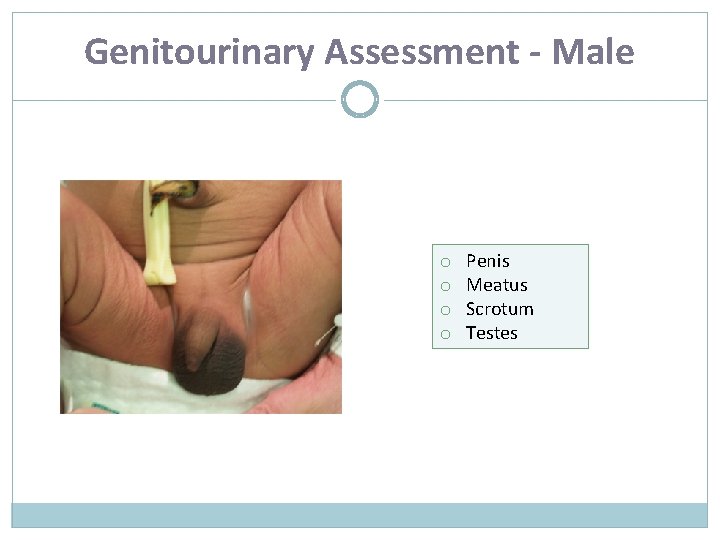 Genitourinary Assessment - Male o o Penis Meatus Scrotum Testes 