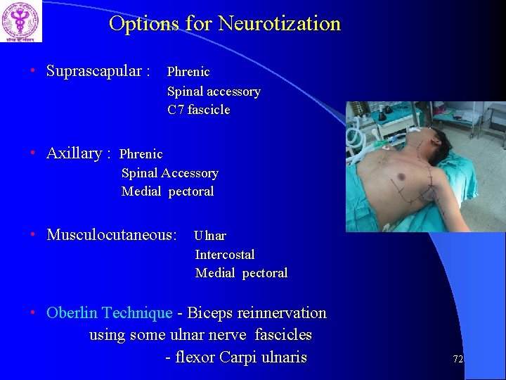 Options for Neurotization • Suprascapular : Phrenic Spinal accessory C 7 fascicle • Axillary