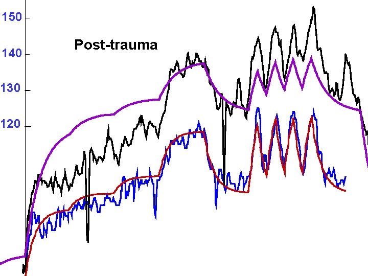 150 140 130 120 Post-trauma 150 140 130 120 Post-trauma