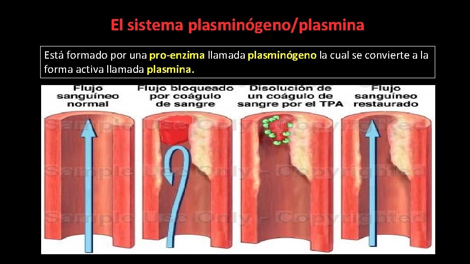 El sistema plasminógeno/plasmina Está formado por una pro-enzima llamada plasminógeno la cual se convierte