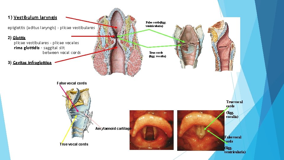 1) Vestibulum laryngis False cords(ligg. ventricularia) epiglottis (aditus laryngis) - plicae vestibulares 2) Glottis