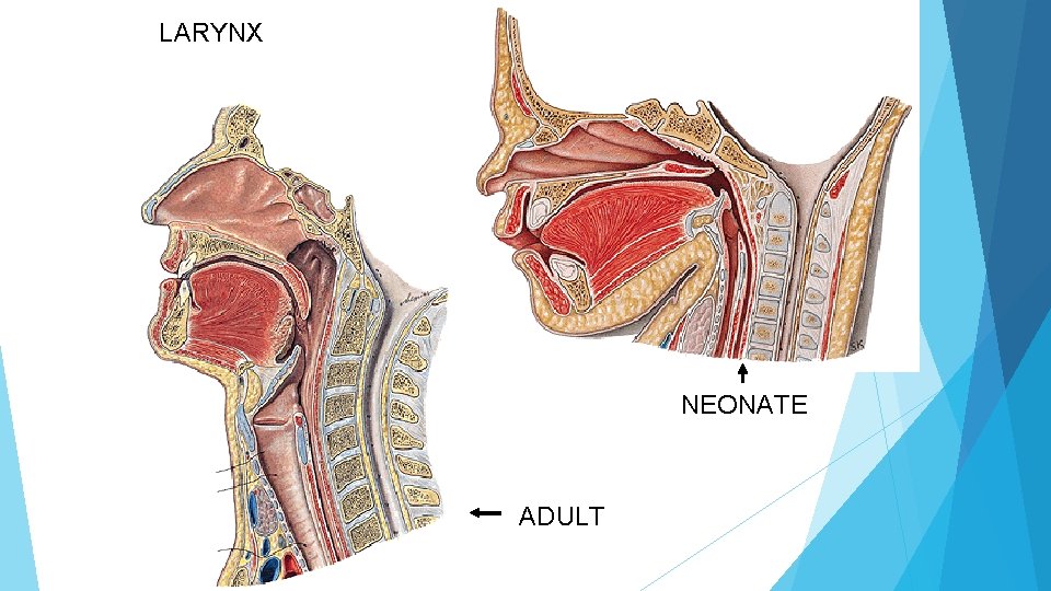 LARYNX NEONATE ADULT 