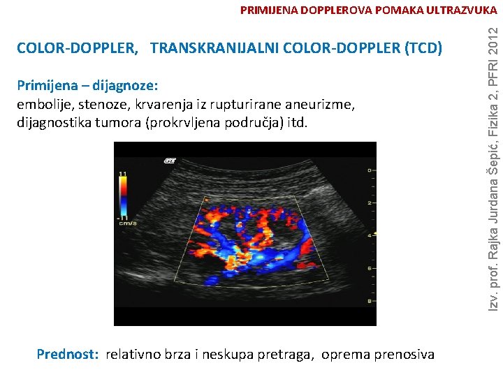 COLOR-DOPPLER, TRANSKRANIJALNI COLOR-DOPPLER (TCD) Primijena – dijagnoze: embolije, stenoze, krvarenja iz rupturirane aneurizme, dijagnostika