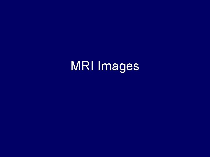 MRI Images MRI Images