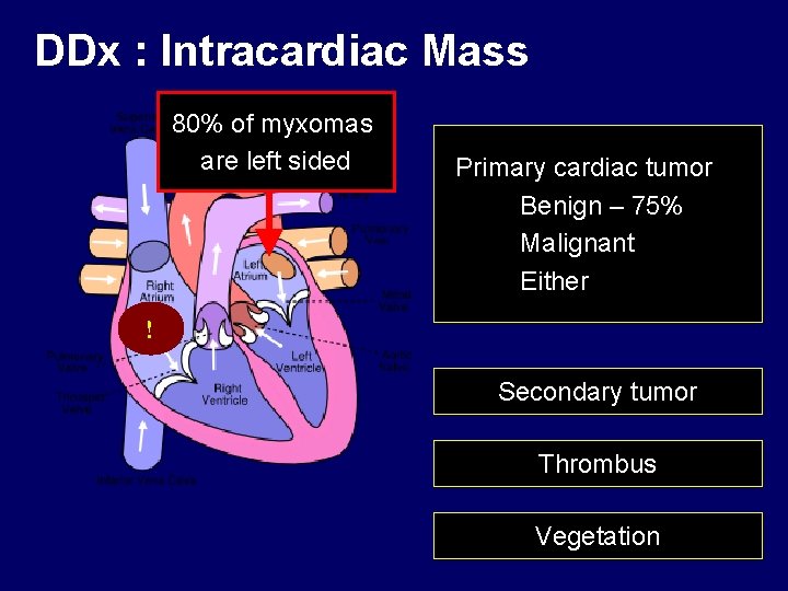 DDx : Intracardiac Mass 80% of myxomas are left sided Primary cardiac tumor Benign DDx : Intracardiac Mass 80% of myxomas are left sided Primary cardiac tumor Benign