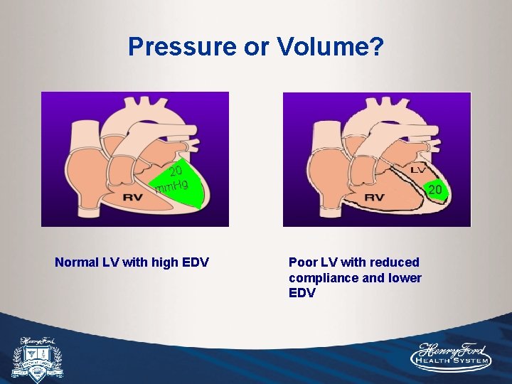 Pressure or Volume? mm. Hg 20 Normal LV with high EDV 20 Poor LV