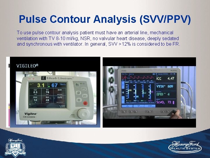 Pulse Contour Analysis (SVV/PPV) To use pulse contour analysis patient must have an arterial