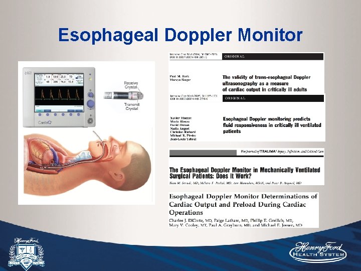 Esophageal Doppler Monitor 