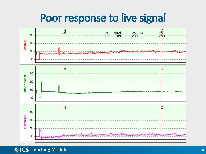 Poor response to live signal Teaching Module 20 