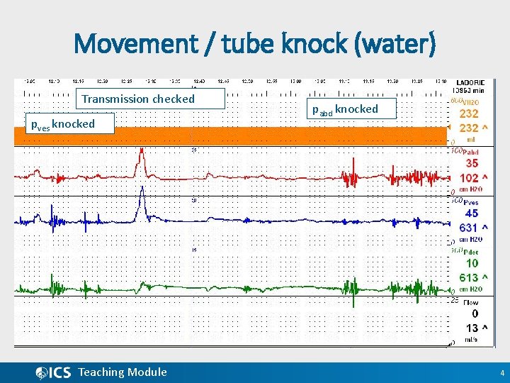 Movement / tube knock (water) Transmission checked pves knocked Teaching Module pabd knocked 4