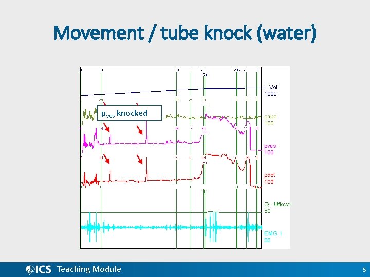 Movement / tube knock (water) pves knocked Teaching Module 5 