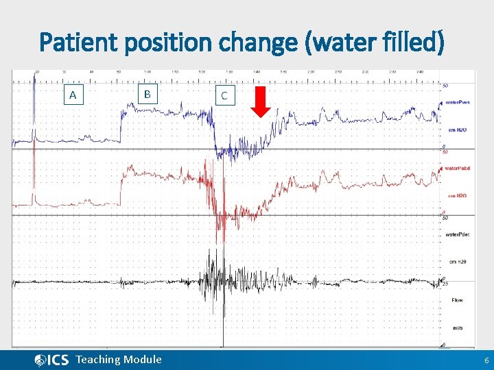 Patient position change (water filled) A B Teaching Module C 6 