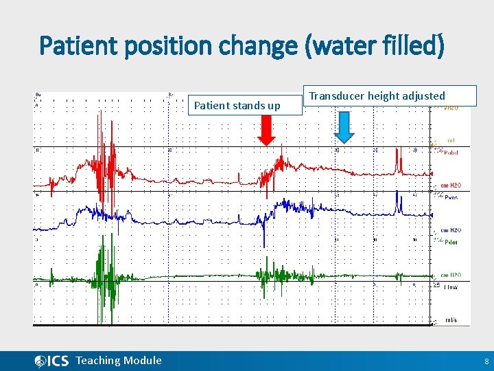 Patient position change (water filled) Patient stands up Teaching Module Transducer height adjusted 8