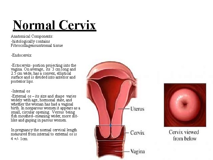Normal Cervix Anatomical Components: -histologically contains Fibrocollagenousstromal tissue -Endocervix -Ectocervix- portion projecting into the